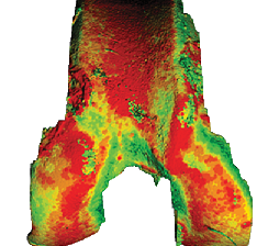 Read more: Engineered Biomaterials and Biomechanics