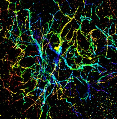 Read more: Microscopic Imaging - Fang Huang